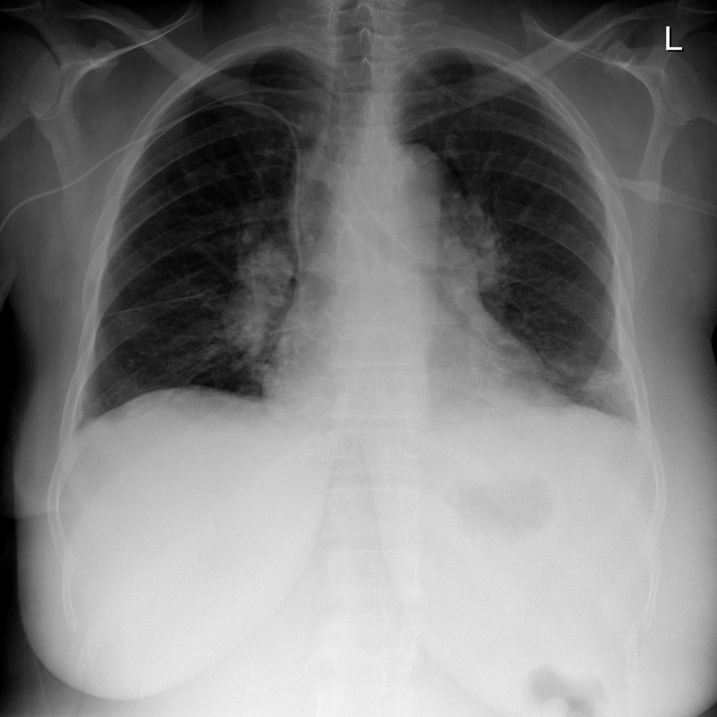 Mass representative X-ray